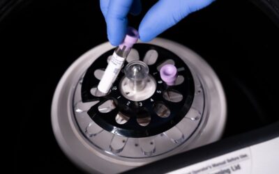 Top Features to Look for in a Serological Centrifuge