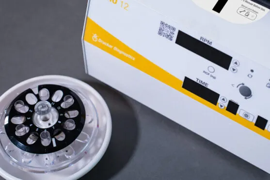 How to Choose a Serological Centrifuge: Essential Features Guide