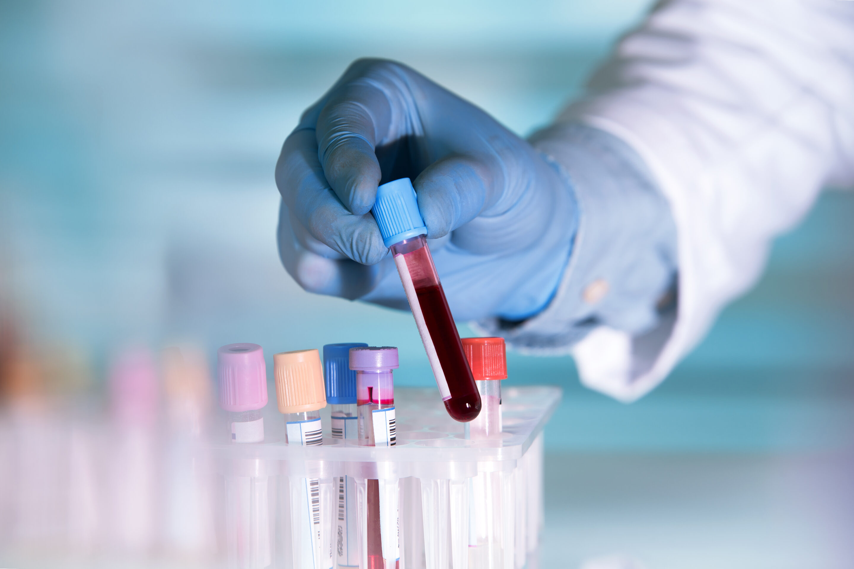 lab technician holding blood tube sample for study