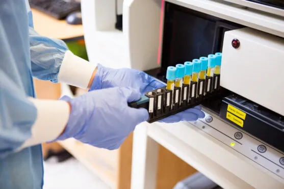 Centrifuge Tube Guide: Types, Sizes, and Selection for Clinical Labs