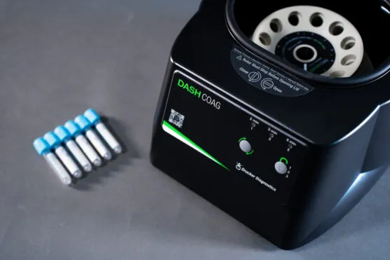 How Centrifugation Impacts Coagulation Testing