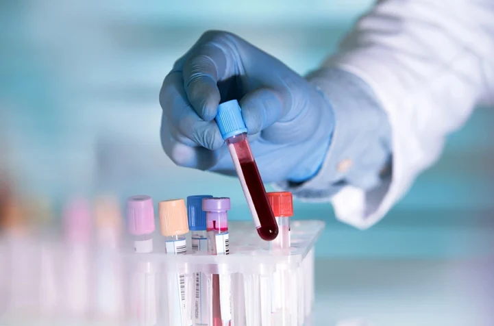 Drucker Diagnostics
