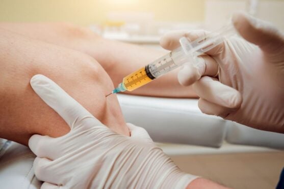 PRP, PRF, and Exosomes: Where Centrifugation Fits in the Future of Regenerative Medicine
