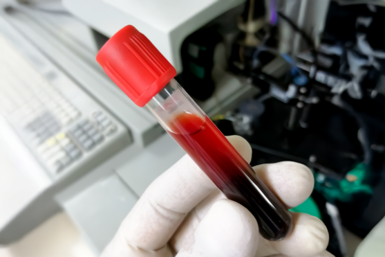 Can Improper Centrifugation Invalidate Test Results?