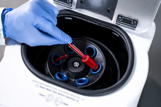 Microhematocrit Centrifuge for Veterinary Practices: What You Need and Why